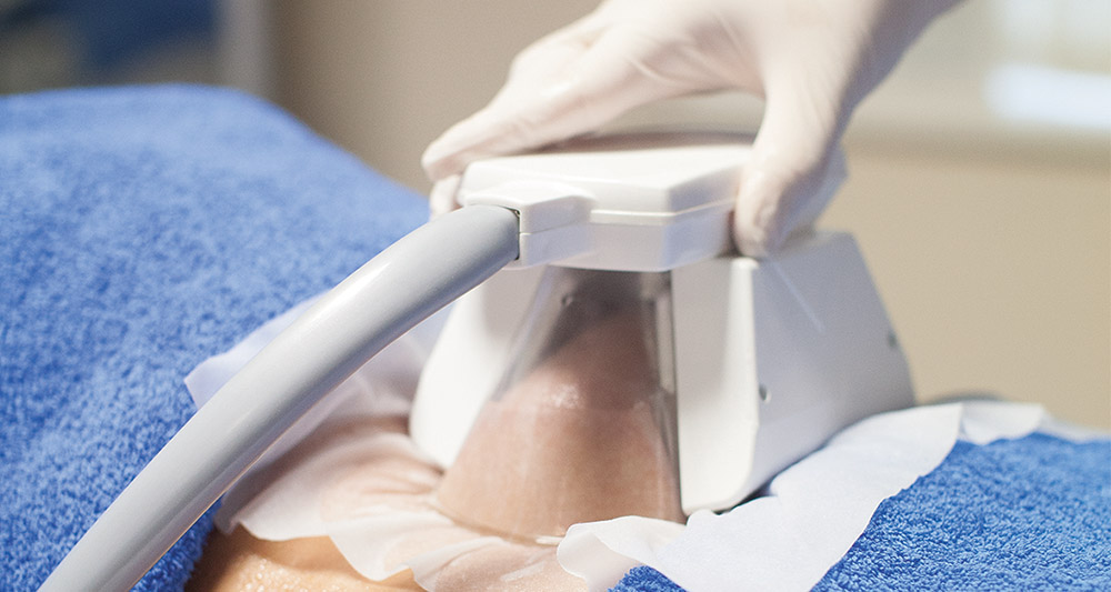 How Fat Freezing and HIFU Work Together? 2 Multiple Areas in One Session HIFU and Fat Freezing Greenock
