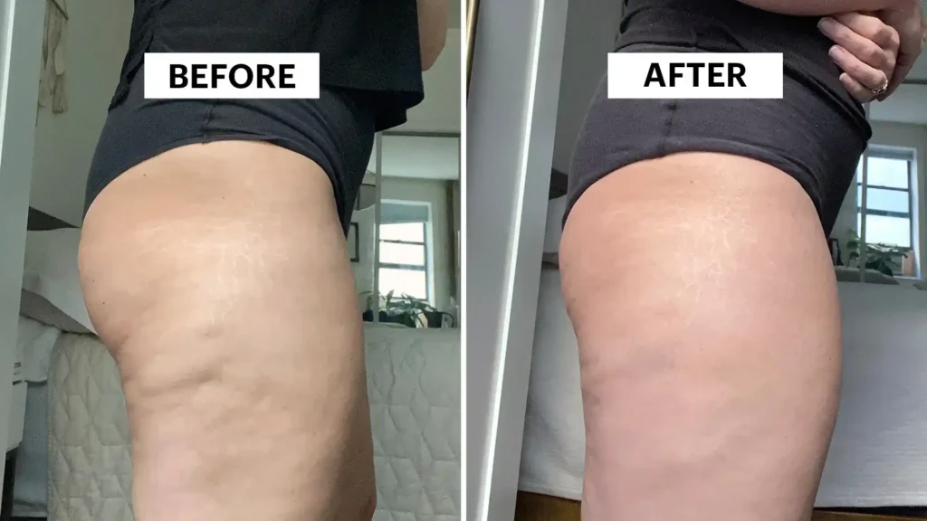 Sculpting Your Bum: Can Toning Exercises Really Reduce Cellulite? 1 Do Toning Exercise Greenock Really Tackle Cellulite?