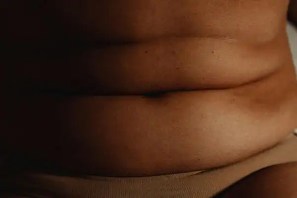 The Hidden Connection: How Stress Shapes Your Fitness and Body Composition 3 image of what stress can do on the stomach area and how Lipo 360 Greenock can help to change your body shape.
